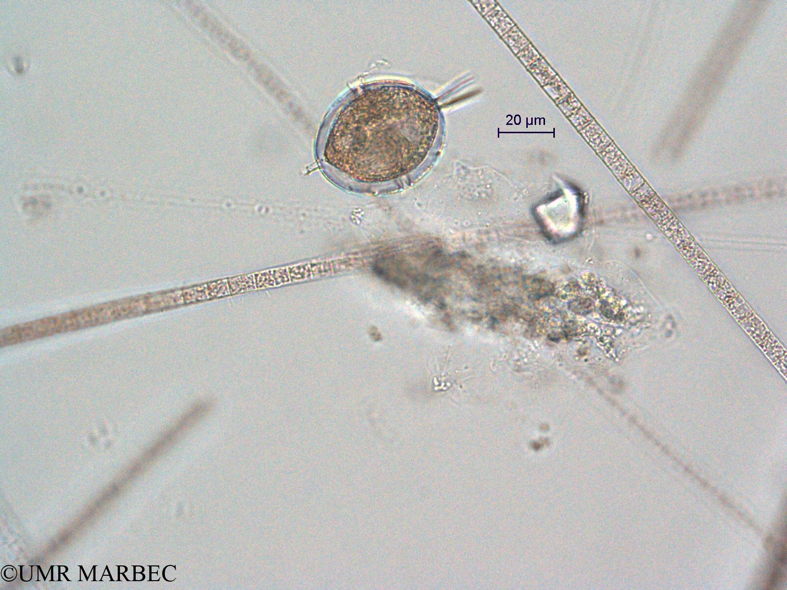 phyto/Scattered_Islands/all/COMMA April 2011/Protoperidinium sp29 (ancien Protoperidinium sp20 cf angusticollis)(copy).jpg